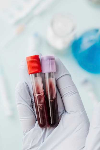 Роль амилазы и липазы в анализе крови