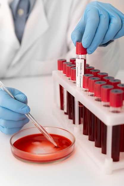 Когда и почему проводится анализ крови на гормоны надпочечников