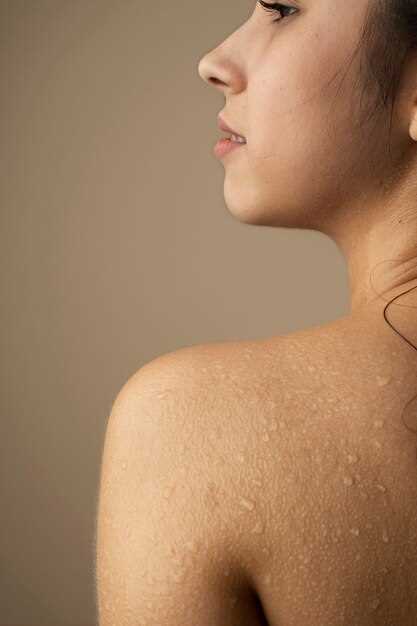 Причины и факторы влияющие на развитие черезоточного хода на коже