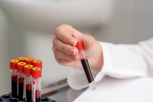 Нормальный уровень гемоглобина в анализах крови