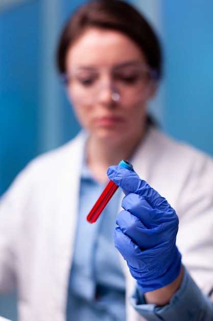 Правильная подготовка к сдаче крови на биохимический анализ