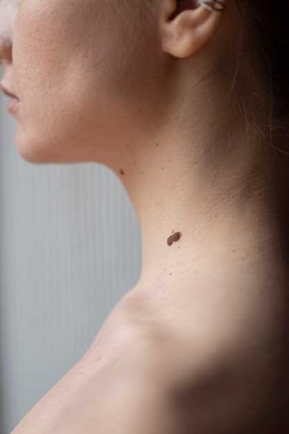 Красные высыпания на половых губах - один из признаков сифилиса у женщин