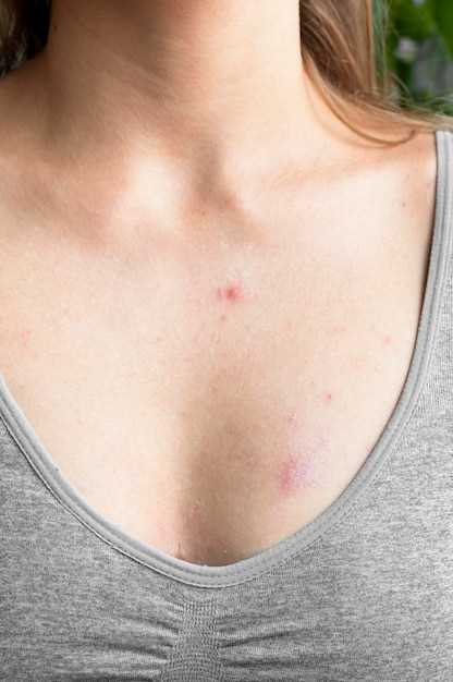 Эффективные способы избавиться от красных пятен от прыщей
