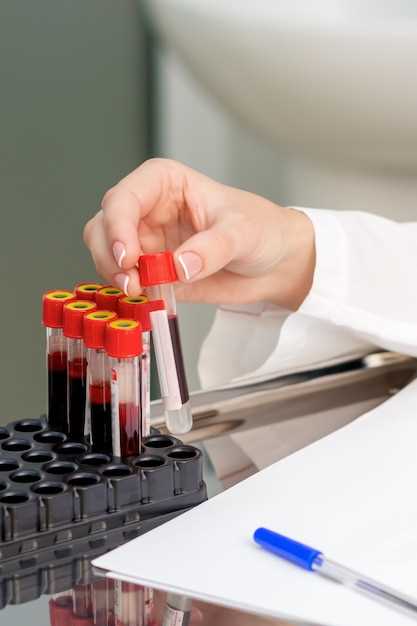 Моноциты: показатели в общем анализе крови
