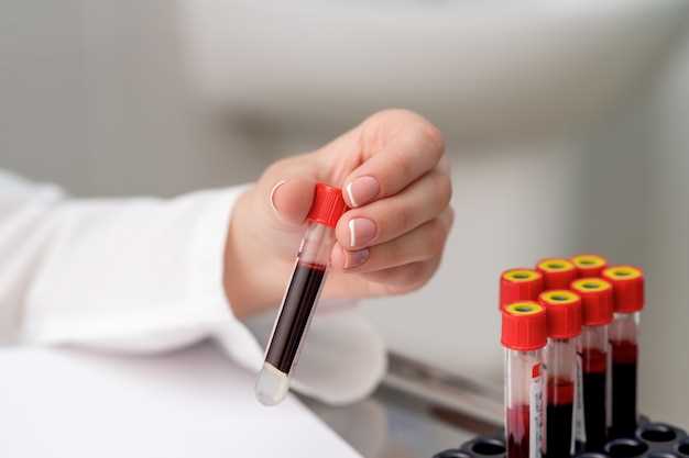 Расшифровка анализа крови: что значит отклонение показателей от нормы
